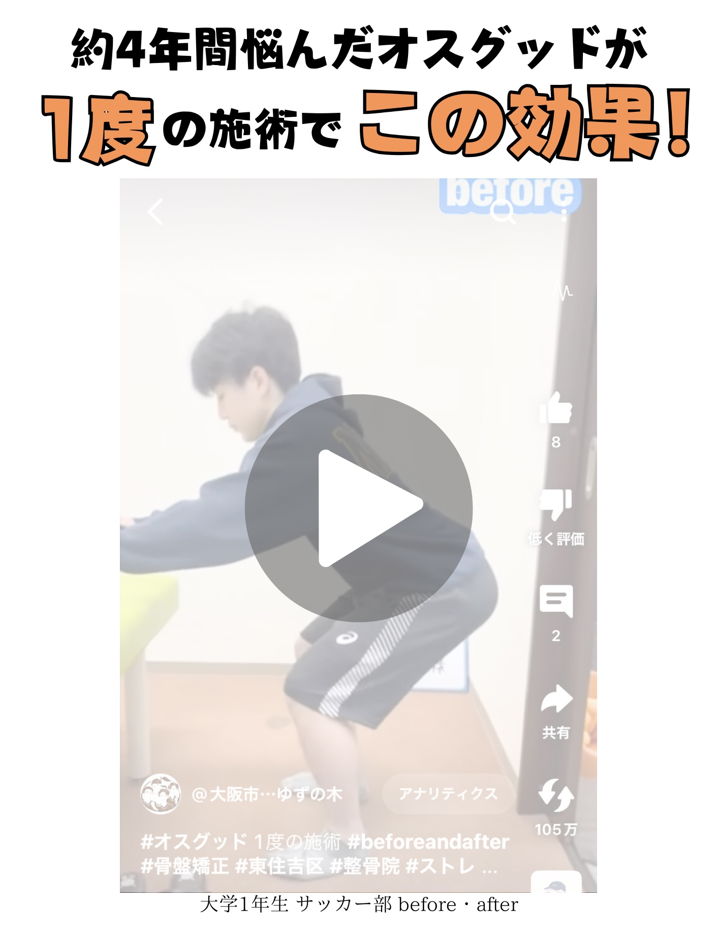 約4年間悩んだオスグッドが - 1